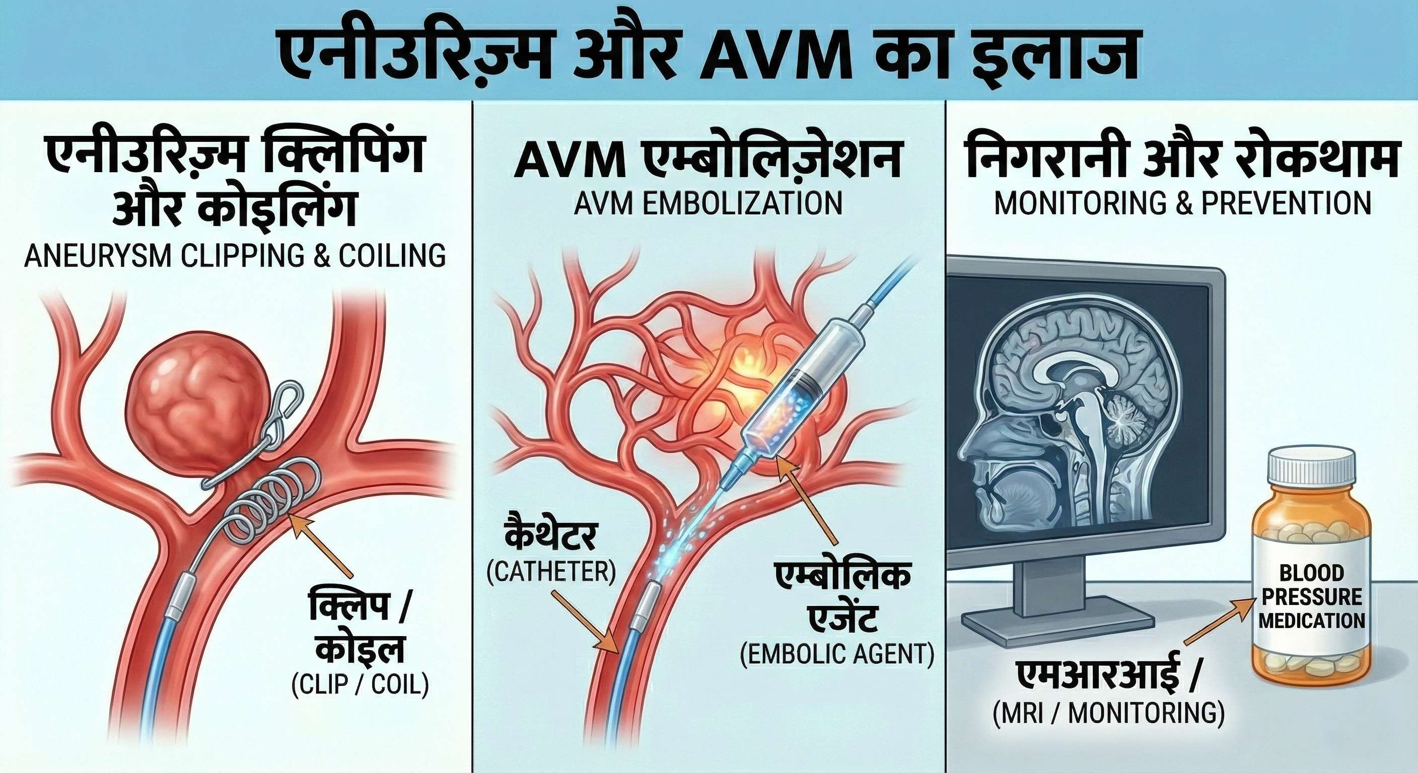 Aneurysm Surgery